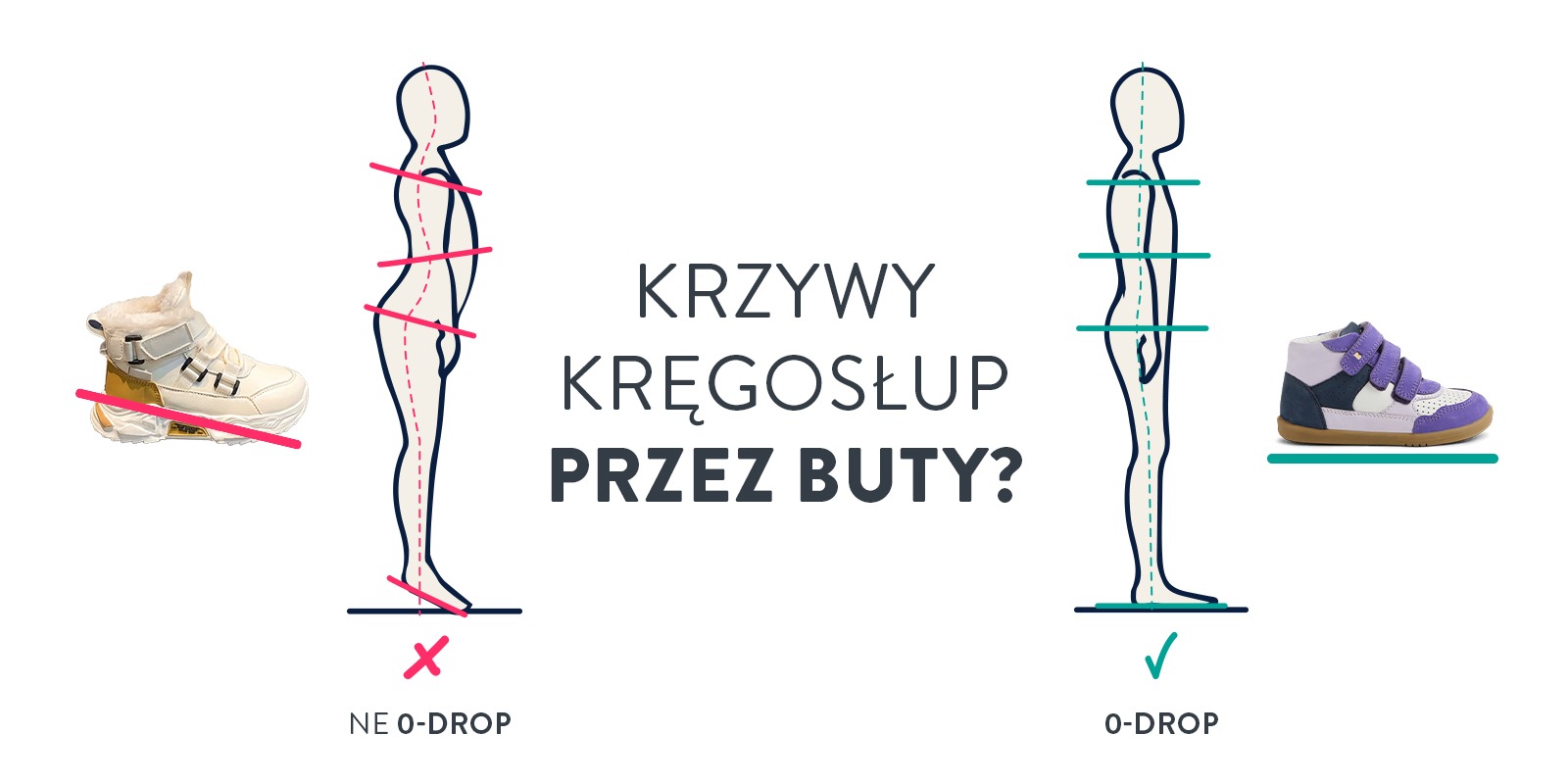 krzywy kręgosłup przez buty